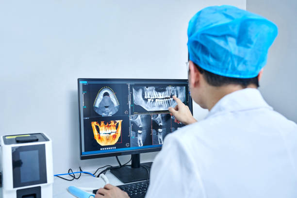 Best Emergency Wisdom Teeth Removal in Meadow Vista, CA